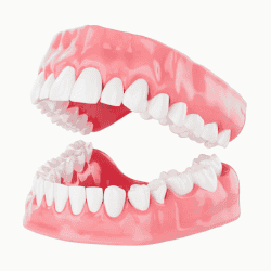 Implantes Dentales En Mexico Precios - 2025